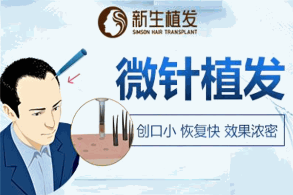 新生植发加盟
